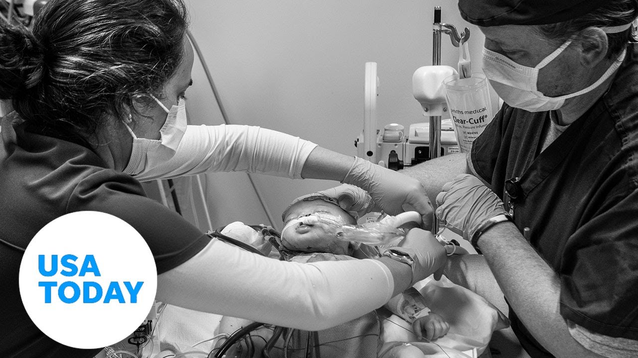 In a pediatric intensive care unit, staff work to save critically ill children | USA TODAY 1