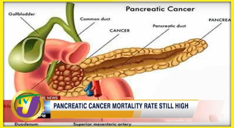 Pancreatic Cancer Mortality rate Still High in Jamaica | TVJ News - Nov 17 2021 1