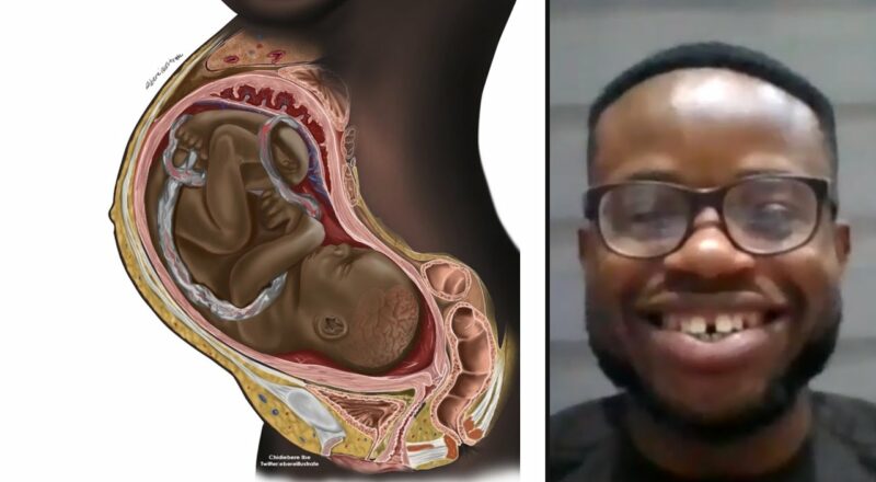 This drawing of a Black pregnant woman is exposing a huge diversity gap in medicine 2