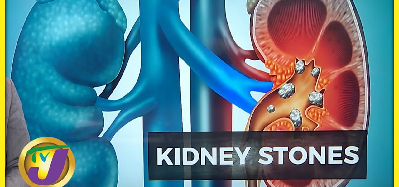 Get checked for Kidney Stones | TVJ News - Feb 23 1