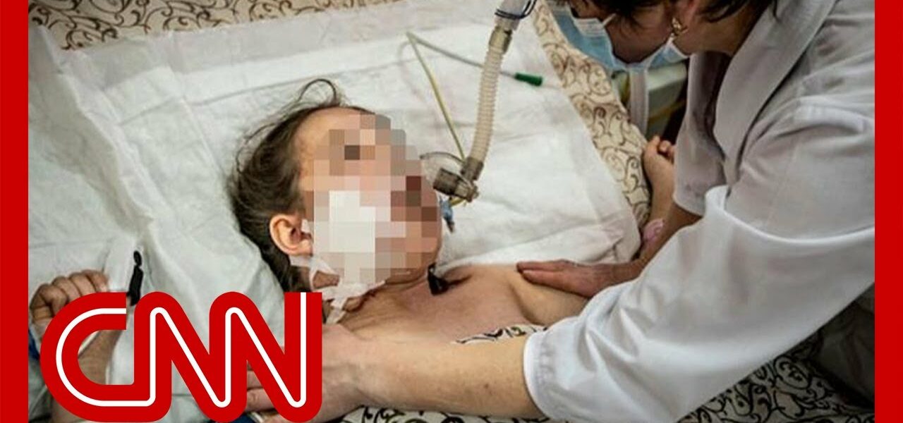 Heartbreaking images show wounded children in Ukraine hospital 1