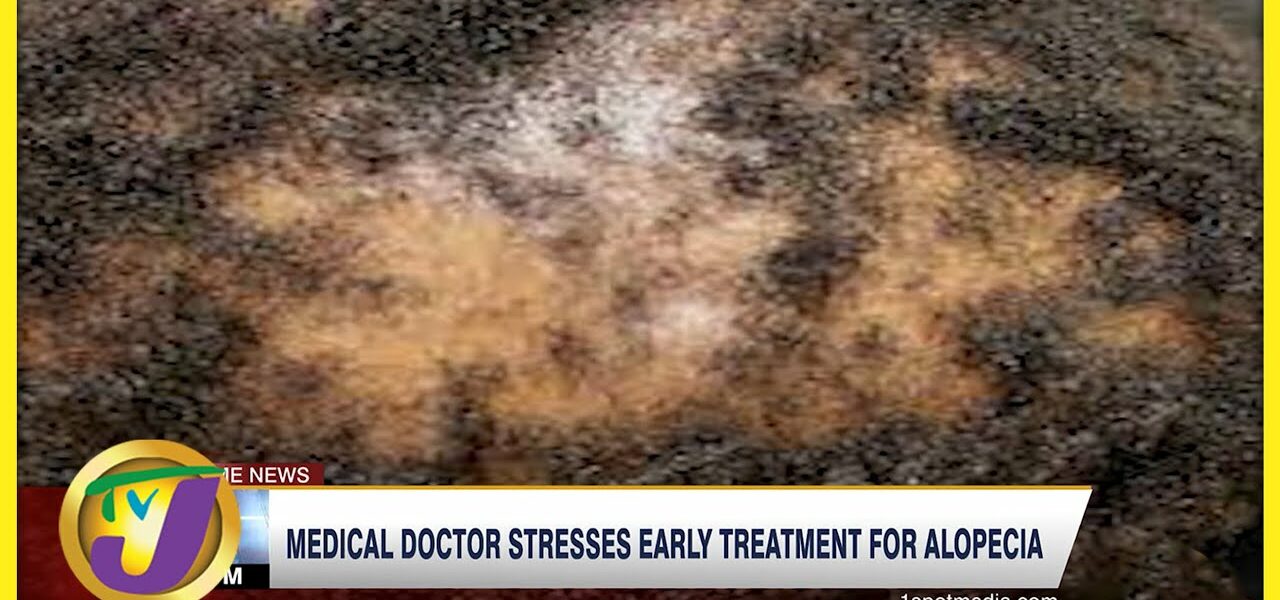 Dr. LLorenia Muir-Green Stresses Early Treatment for Alopecia | TVJ News - April 6 2022 1