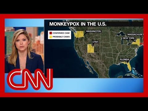 CDC issues new monkeypox warning as more potential cases found 1