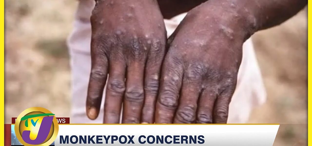 Monkeypox Disease | TVJ News - May 19 2022 1