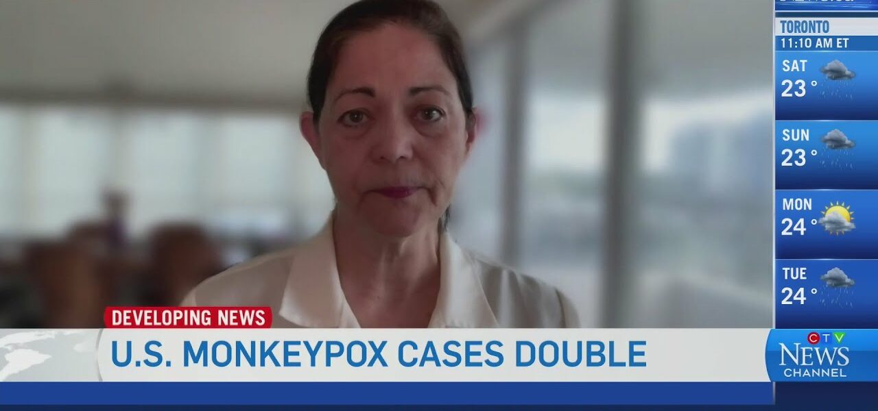 U.S. monkeypox cases have doubled in recent weeks | Expert on how to slow the spread 5